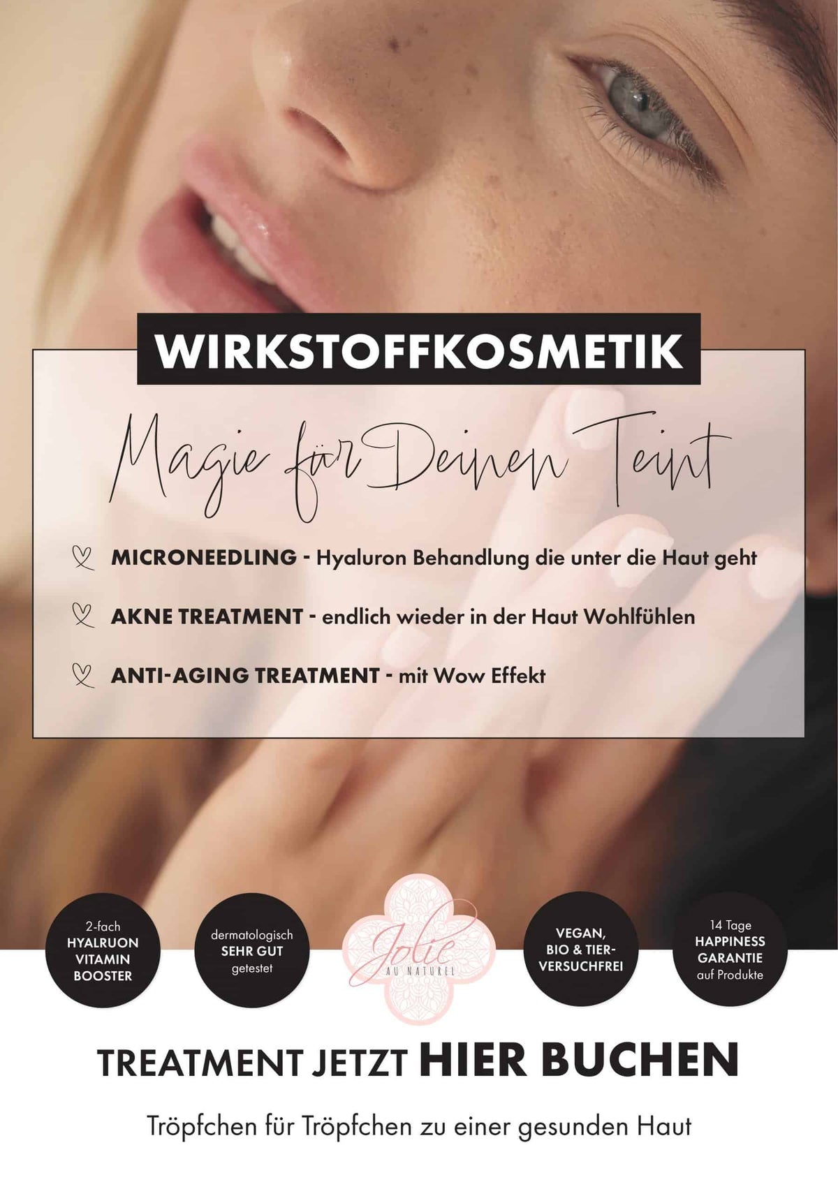 A1 Poster "Microneedling" ausgedruckt - Jolie au naturel: Nachhaltige Naturkosmetik