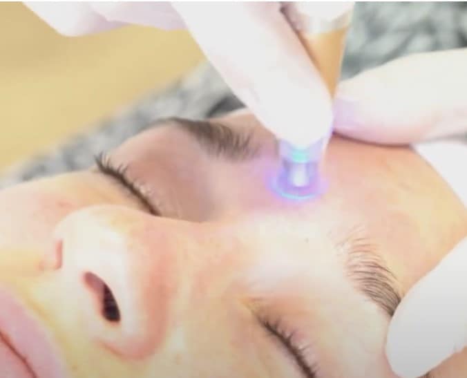 Microneedling Online Schulungsvideo mit Zertifikat - Jolie au naturel: Nachhaltige Naturkosmetik